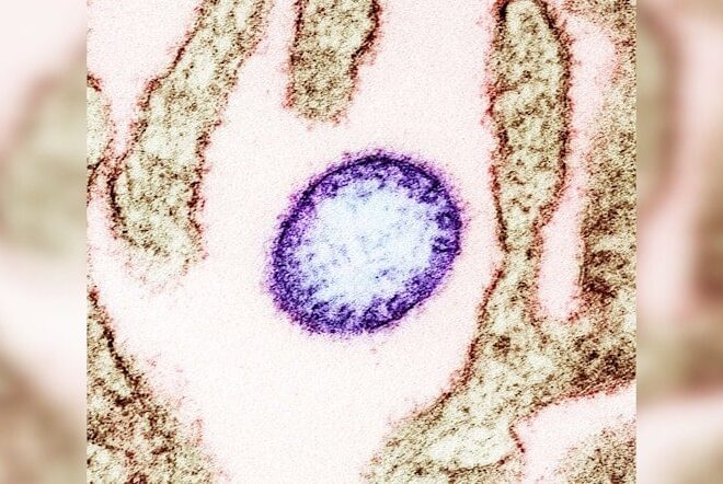 CIDRAP Unveils Updated R&D Roadmap for Nipah Virus Countermeasures