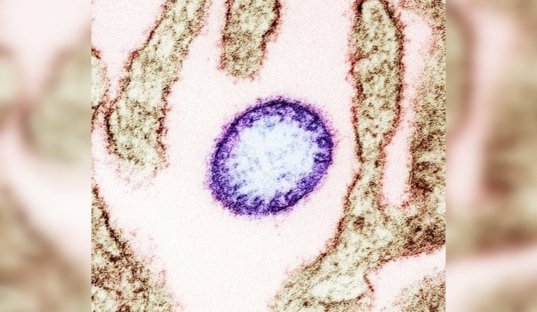 CIDRAP Unveils Updated R&D Roadmap for Nipah Virus Countermeasures